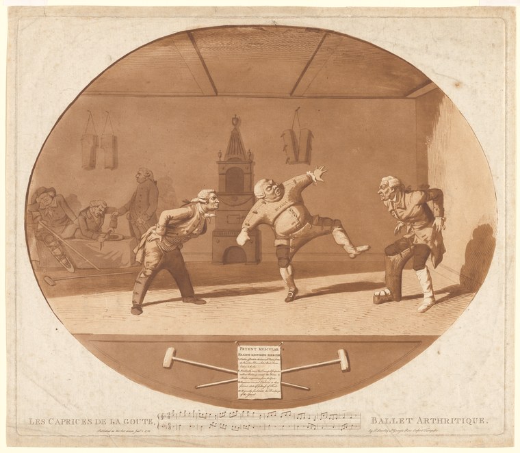 Three men in 18th-century dress perform exaggerated, contorted poses in a theatrical setting, parodying ballet movements as gout symptoms.